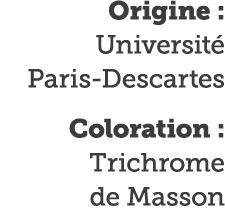 Origine : Universit  Paris-Descartes Coloration : Trichrome de Masson 