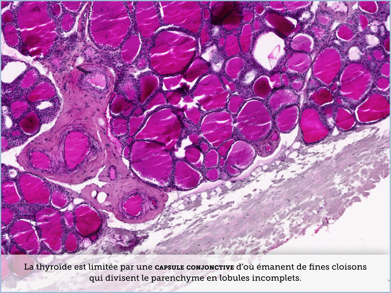 FICHE 2 TUMEUR WARTHIN VIDEO