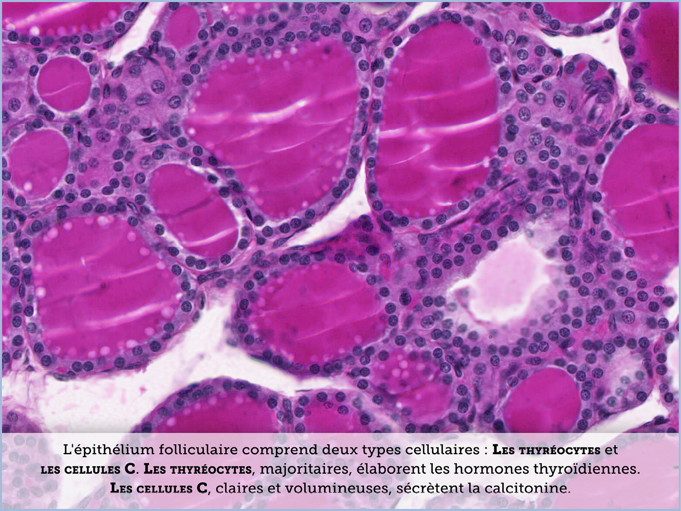 FICHE 2 TUMEUR WARTHIN ECRAN B