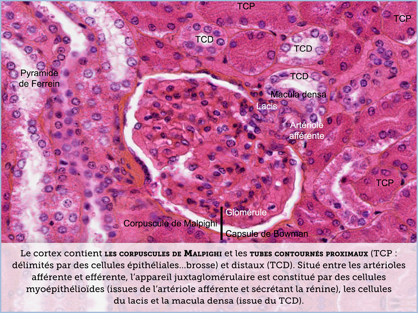 FICHE 2 TUMEUR WARTHIN ECRAN C