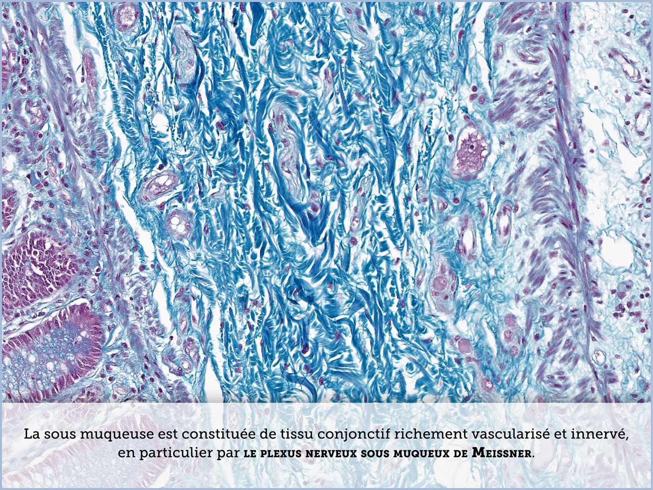 FICHE 2 TUMEUR WARTHIN ECRAN B