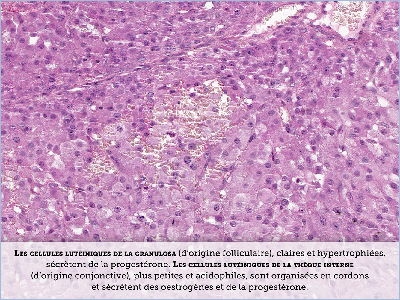 FICHE 2 TUMEUR WARTHIN VIDEO
