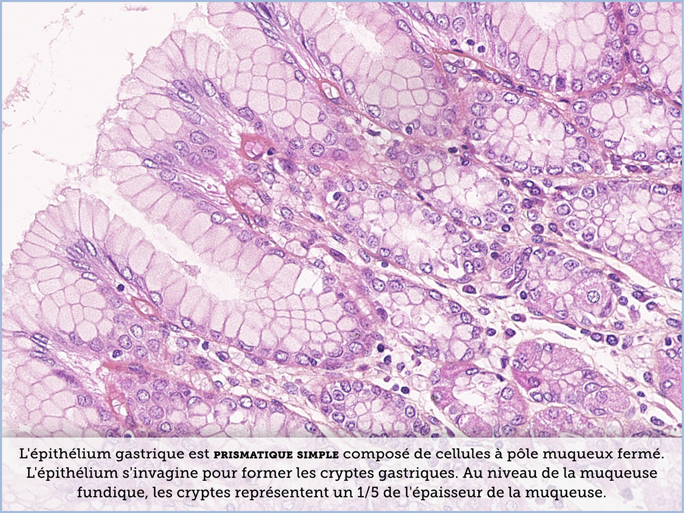 FICHE 2 TUMEUR WARTHIN VIDEO