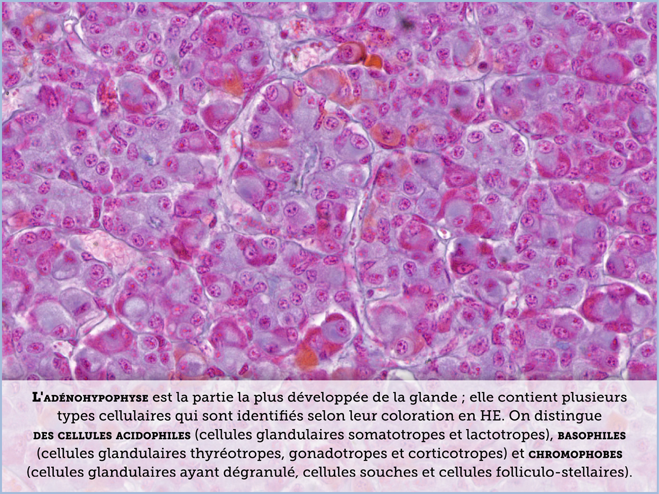FICHE 2 TUMEUR WARTHIN ECRAN C