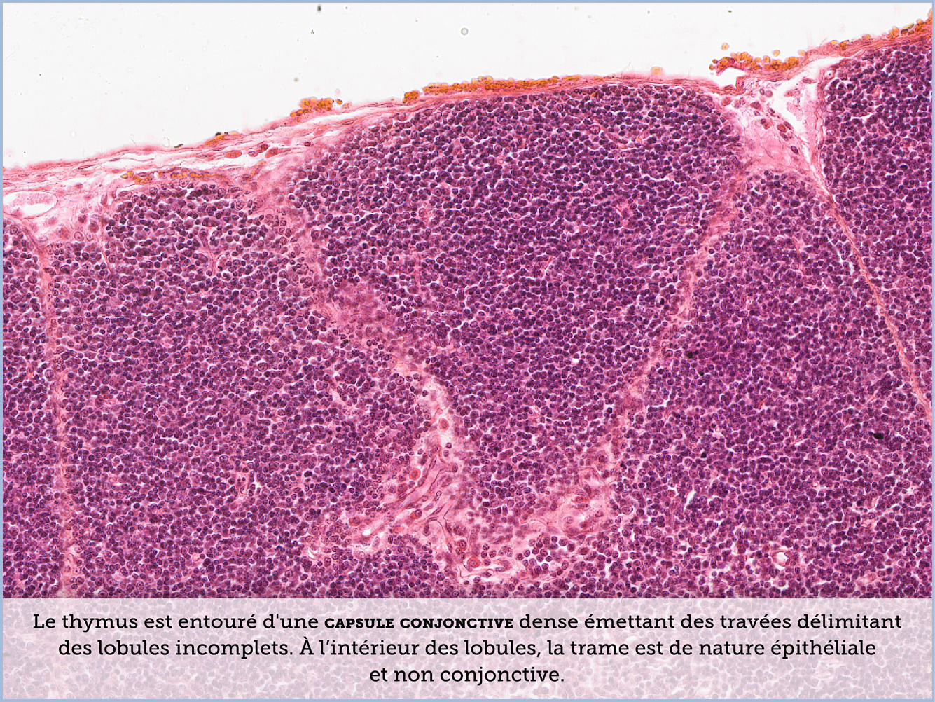 FICHE 2 TUMEUR WARTHIN VIDEO