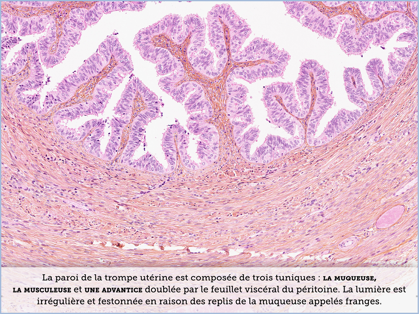 FICHE 2 TUMEUR WARTHIN VIDEO