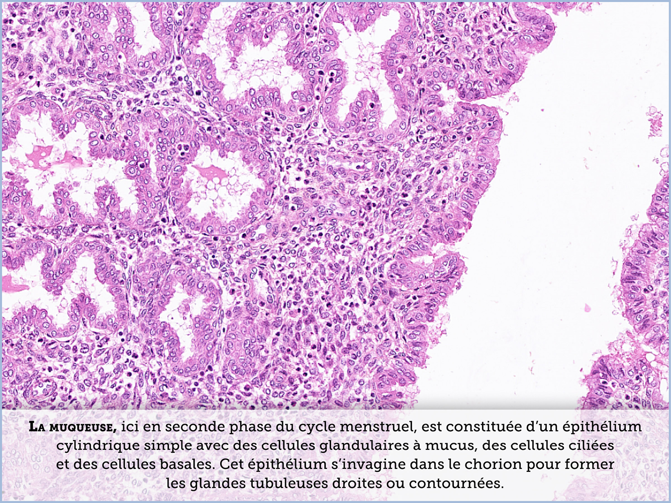 FICHE 2 TUMEUR WARTHIN VIDEO