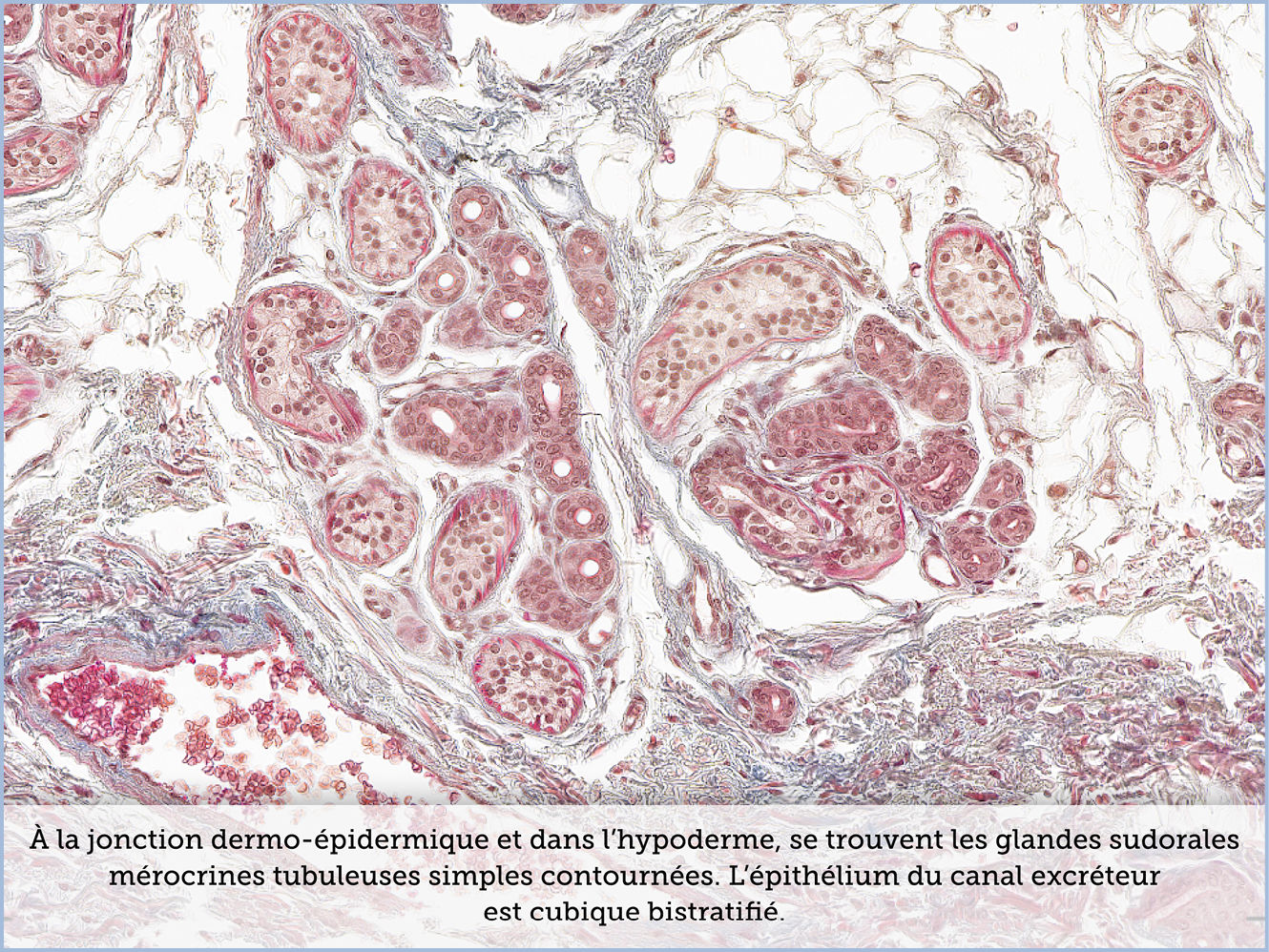 FICHE 2 TUMEUR WARTHIN ECRAN B