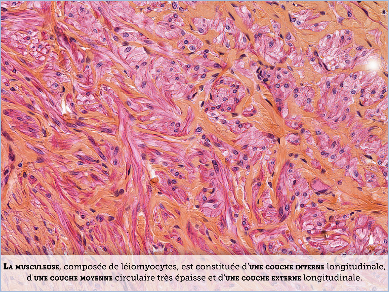 FICHE 2 TUMEUR WARTHIN ECRAN B