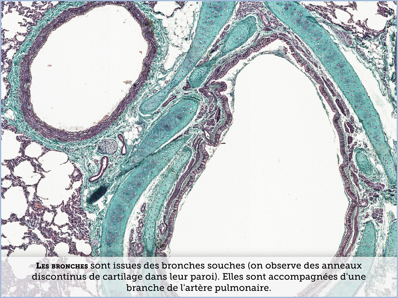 FICHE 2 TUMEUR WARTHIN VIDEO