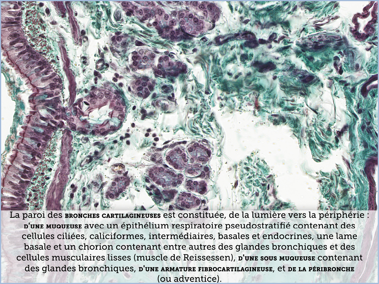 FICHE 2 TUMEUR WARTHIN ECRAN C
