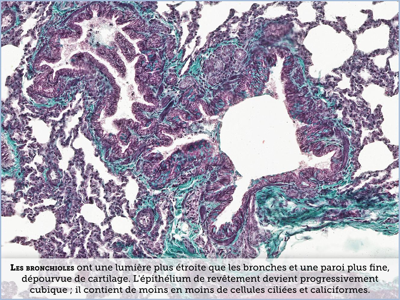 FICHE 2 TUMEUR WARTHIN ECRAN B