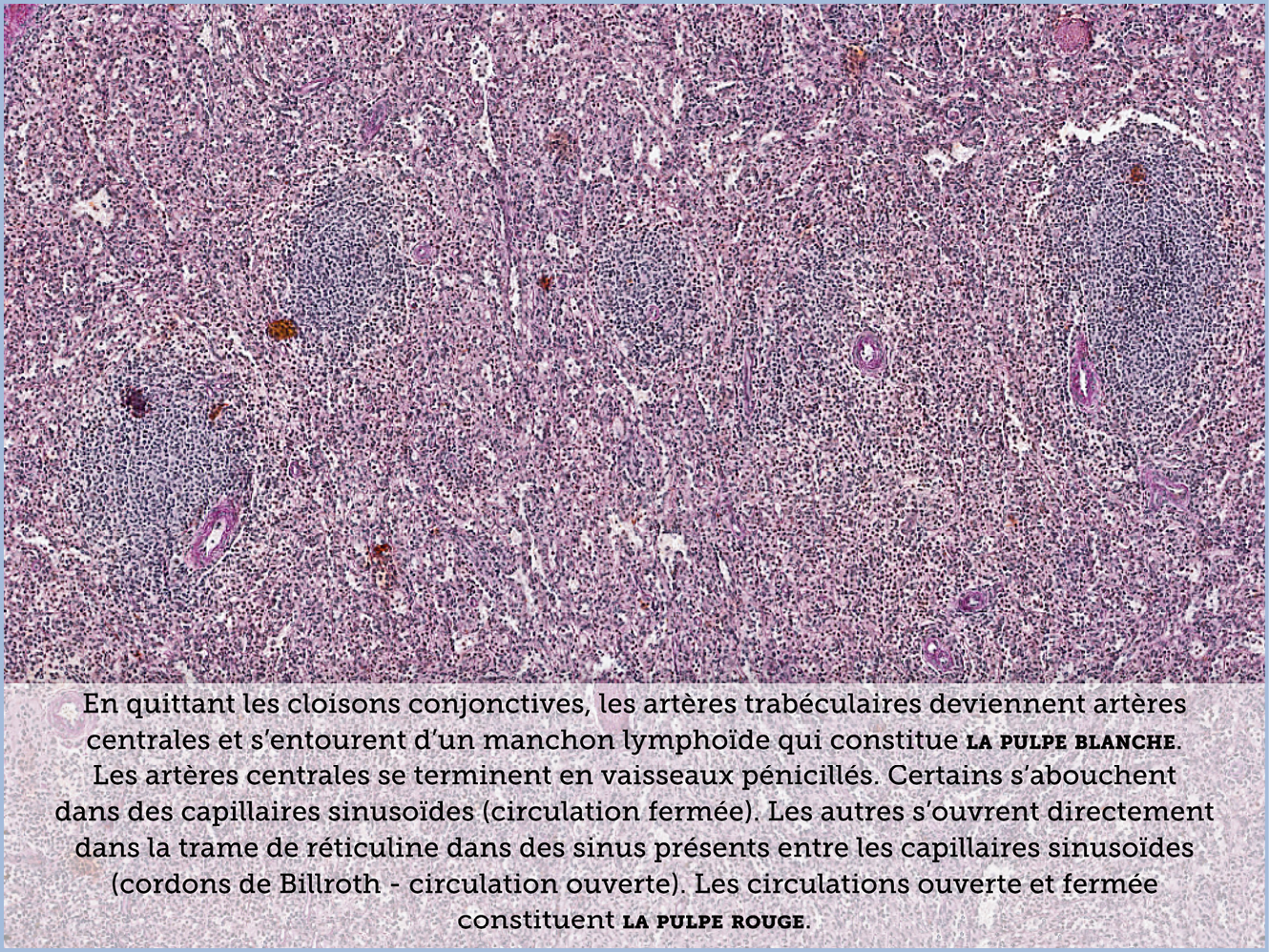 FICHE 2 TUMEUR WARTHIN ECRAN C