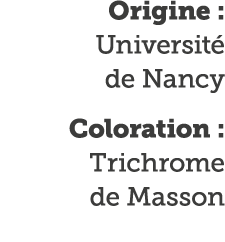 Origine : Universit  de Nancy Coloration : Trichrome de Masson
