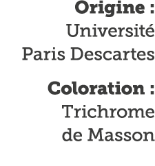 Origine : Universit  Paris Descartes Coloration : Trichrome de Masson