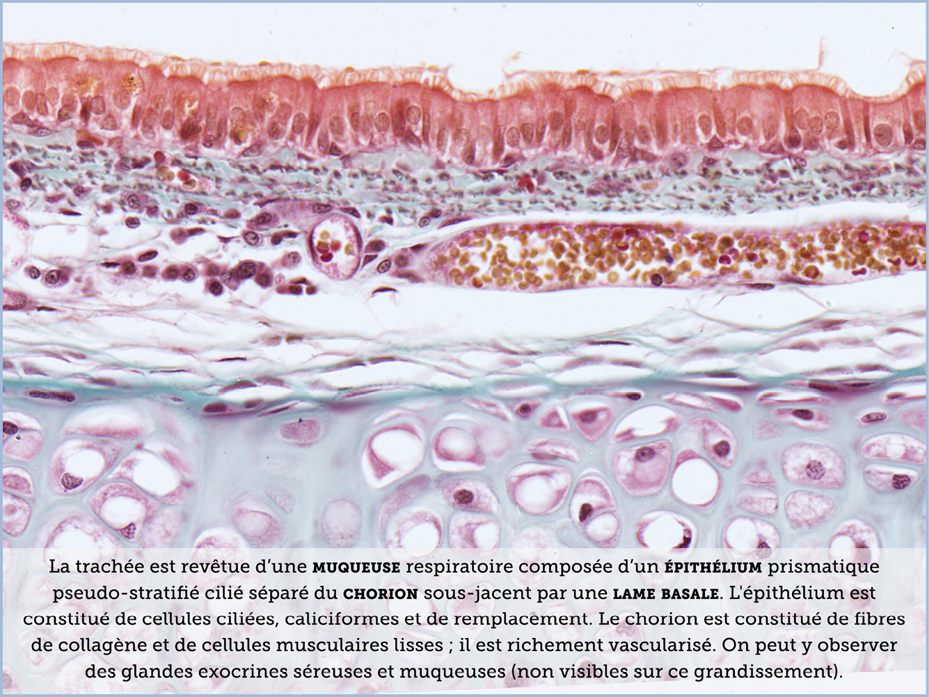 FICHE 2 TUMEUR WARTHIN VIDEO