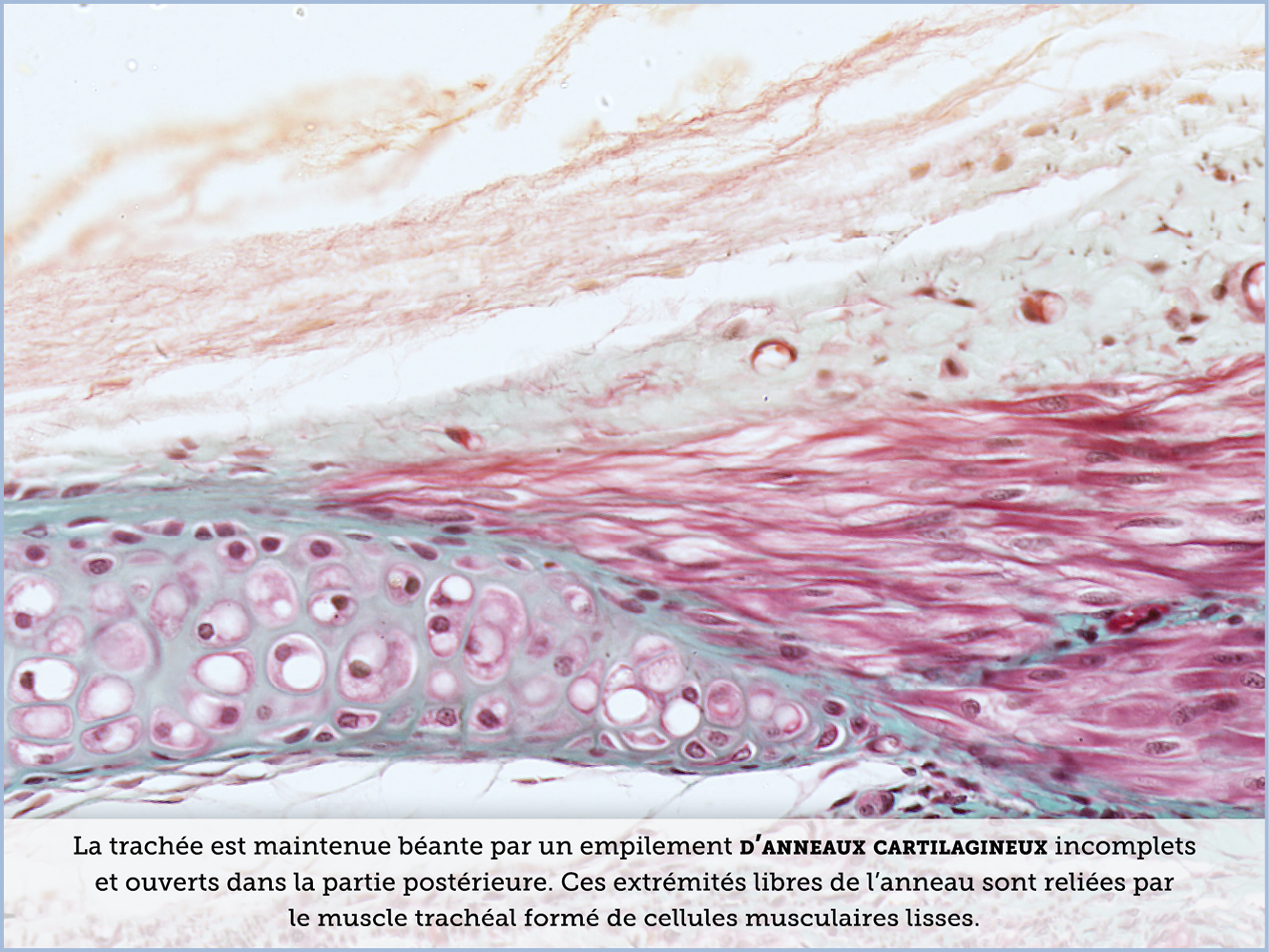 FICHE 2 TUMEUR WARTHIN ECRAN C