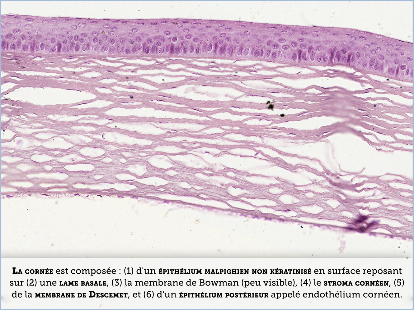 FICHE 2 TUMEUR WARTHIN ECRAN C
