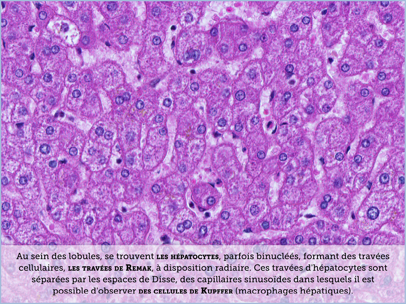 FICHE 2 TUMEUR WARTHIN ECRAN B