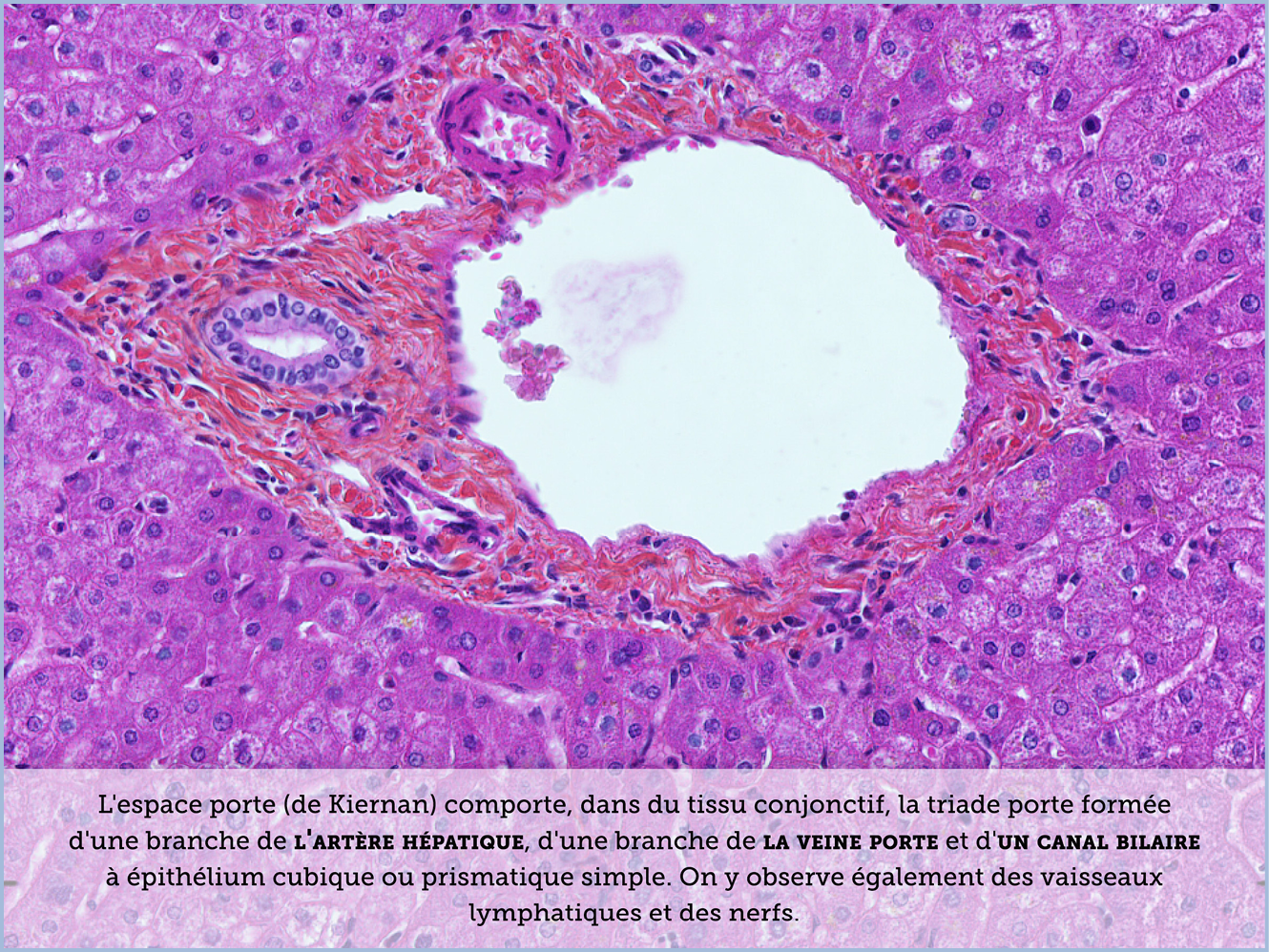 FICHE 2 TUMEUR WARTHIN ECRAN A