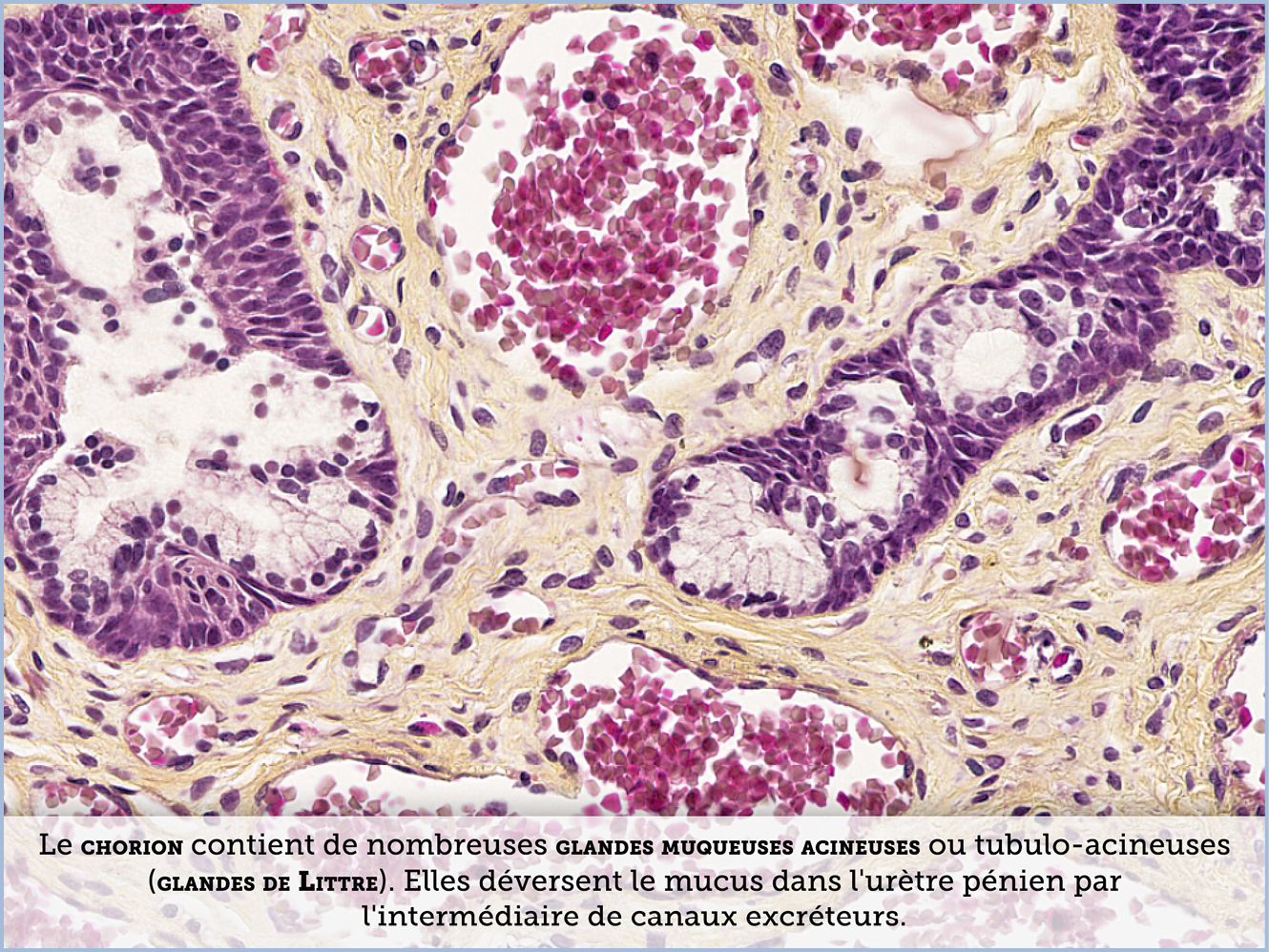 FICHE 2 TUMEUR WARTHIN ECRAN B
