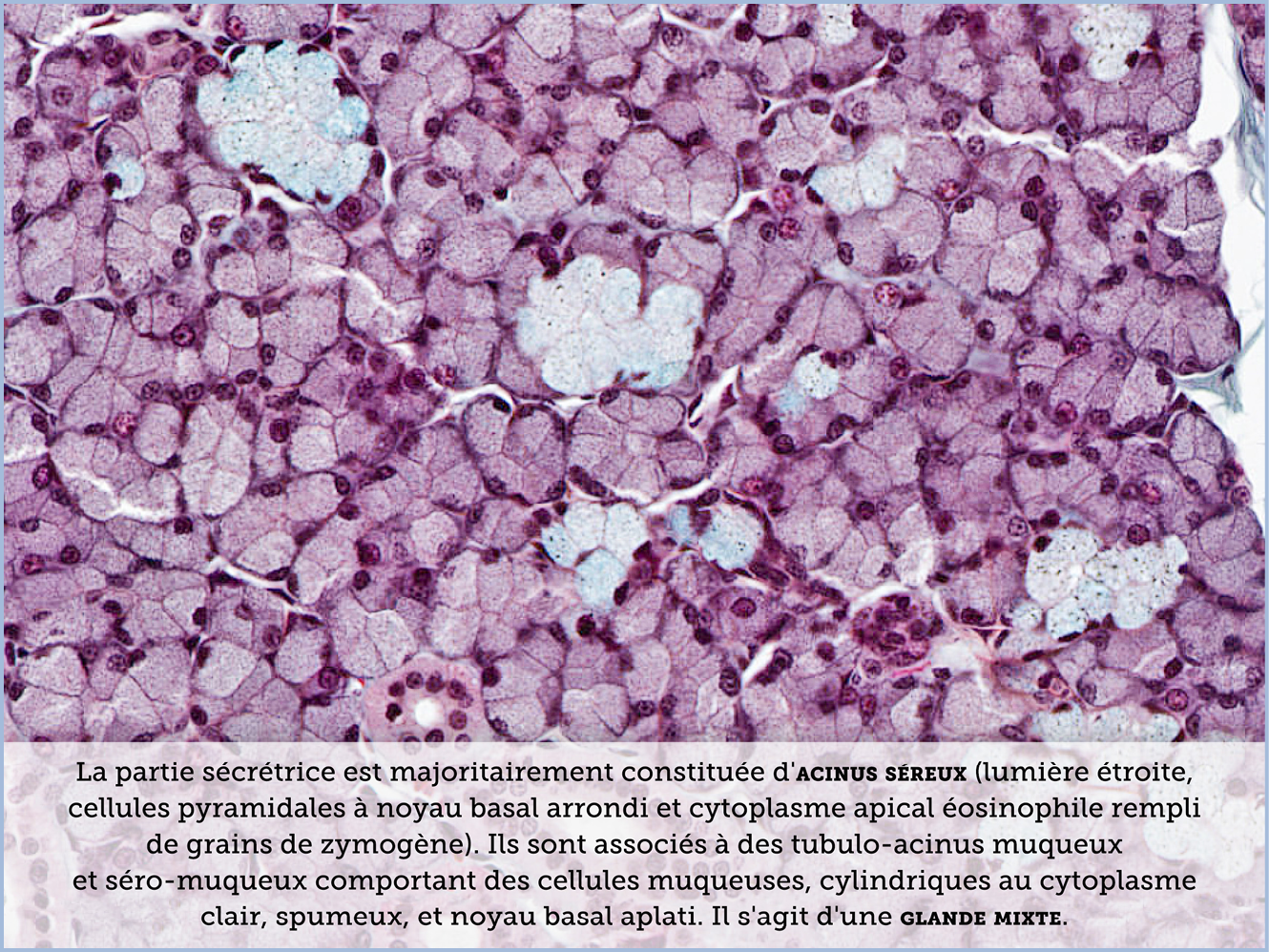 FICHE 2 TUMEUR WARTHIN ECRAN C