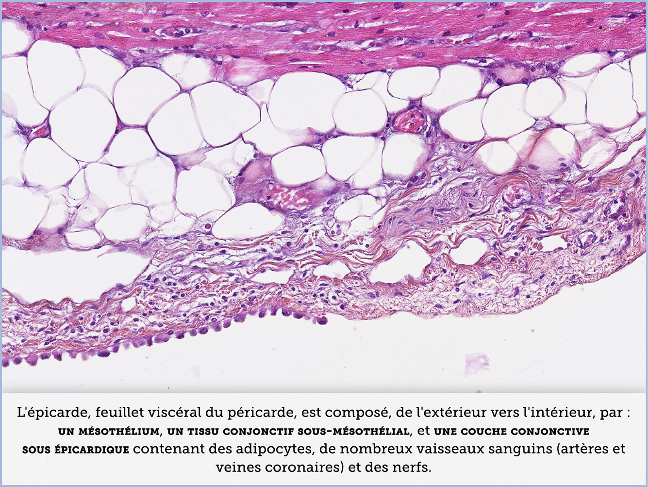 FICHE 2 TUMEUR WARTHIN VIDEO