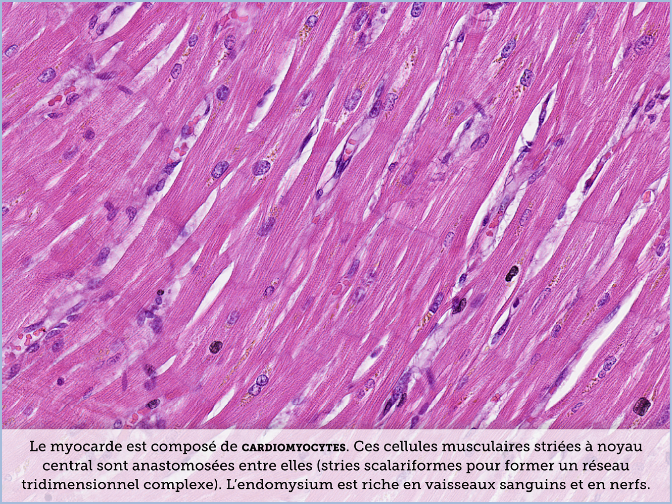 FICHE 2 TUMEUR WARTHIN ECRAN C