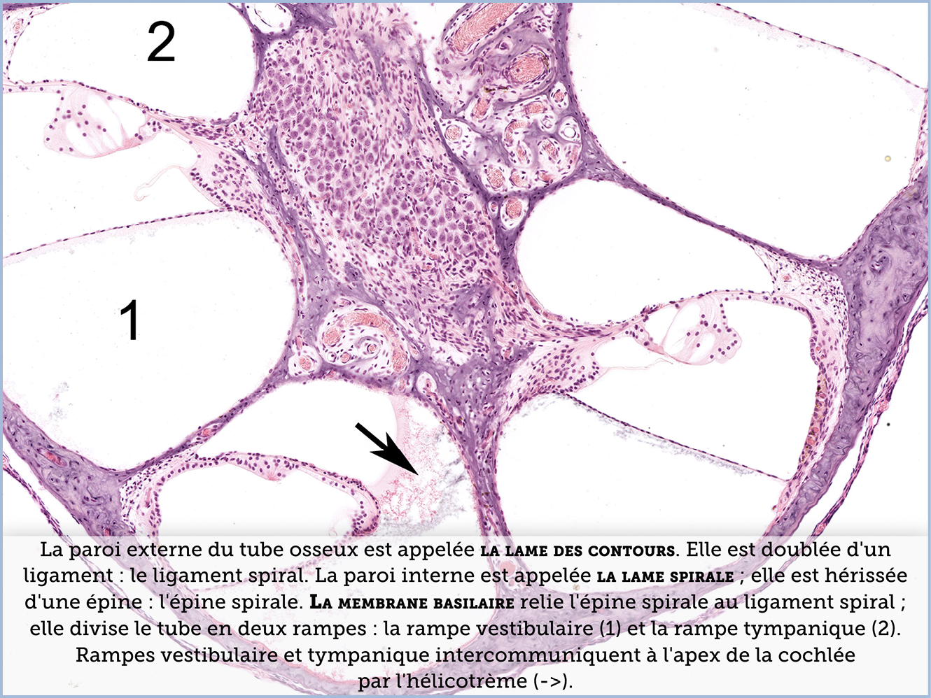 FICHE 2 TUMEUR WARTHIN ECRAN C
