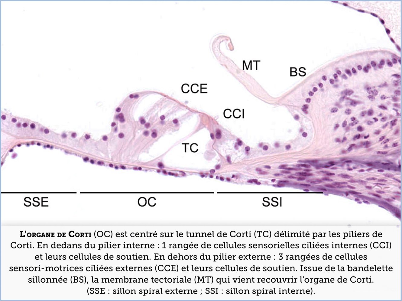 FICHE 2 TUMEUR WARTHIN ECRAN A